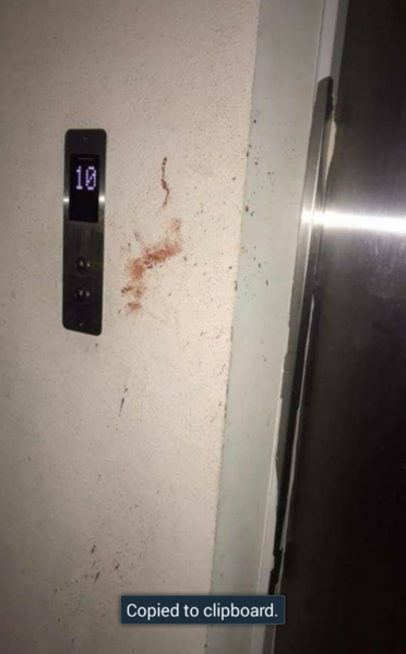 Матрын булан: “Х Apartment” хотхоны лифтнээс хүн унаж гэмтжээ